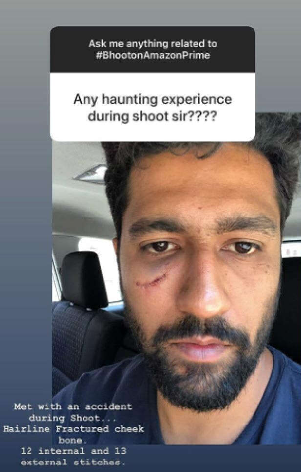 Vicky Kaushal SHOCKS the internet with his long beard, fans say 'he looks  like a villain