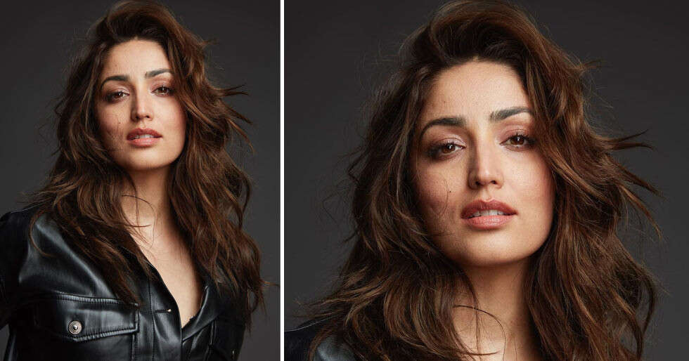 Yami Gautam’s word on self-love after she reveals she has Keratosis Pilaris