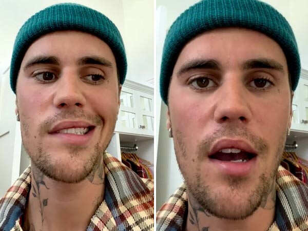 Justin Bieber Reveals That Half His Face Is Paralysed As He S Diagnosed With A Rare Syndrome Filmfare Com