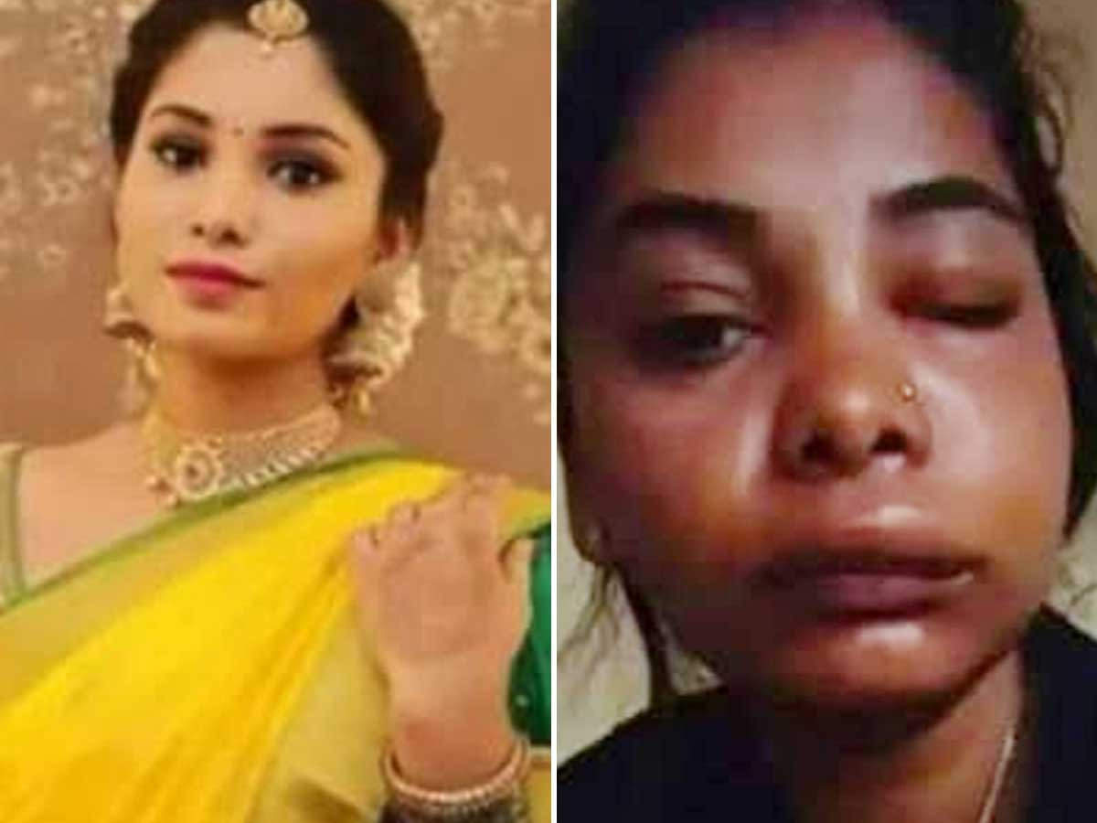 Kannada actress Swathi Sathish's root canal surgery goes horribly ...