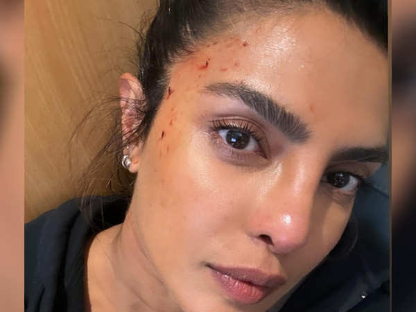 Priyanka Chopra Jonas shares another bloodied up picture from work