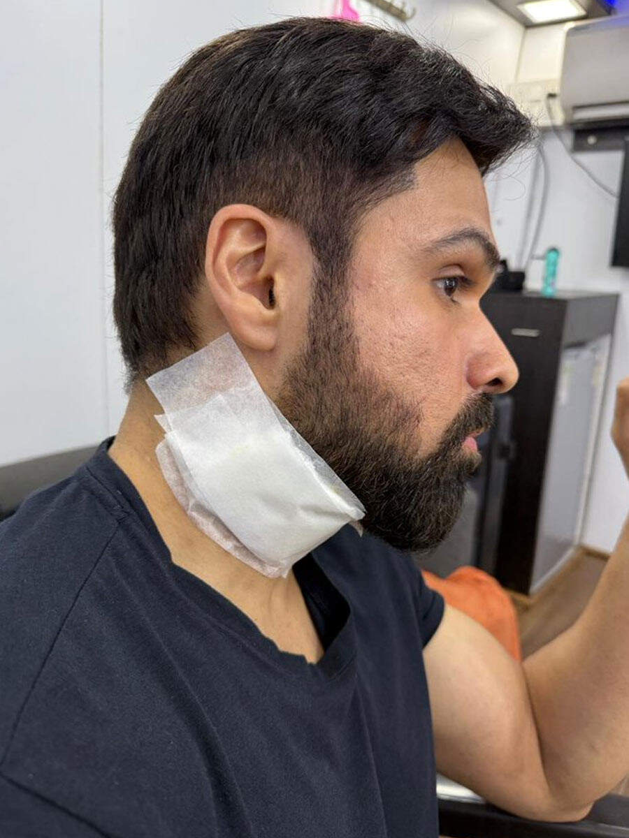 Emraan Hashmi injured