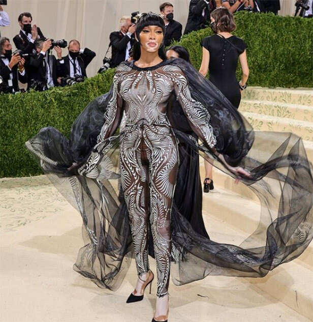 Winnie Harlow
