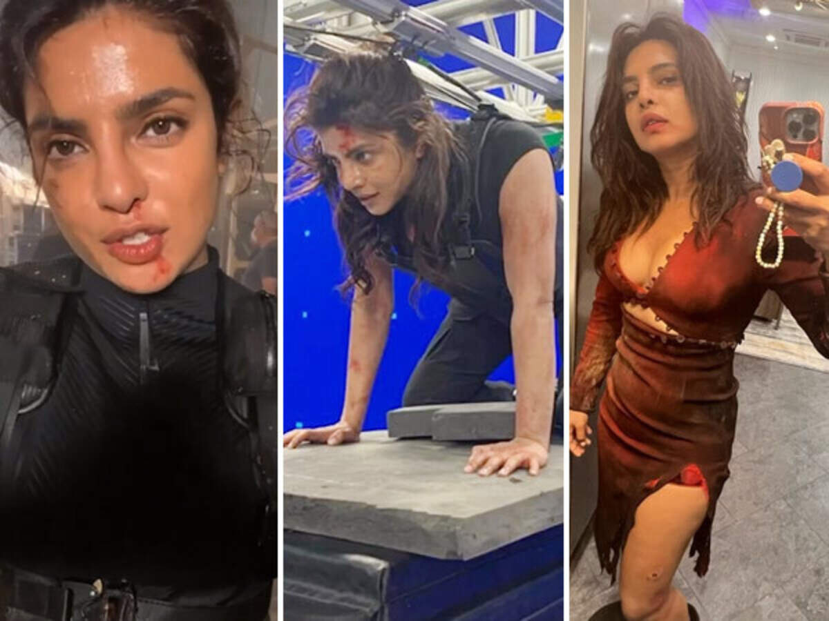 Citadel' Star Priyanka Chopra Jonas Reveals On-Set Injury